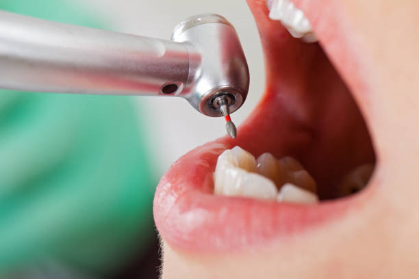 Best Weekend Emergency Dentist in Mion, AR